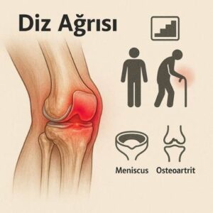 diz ağrısı