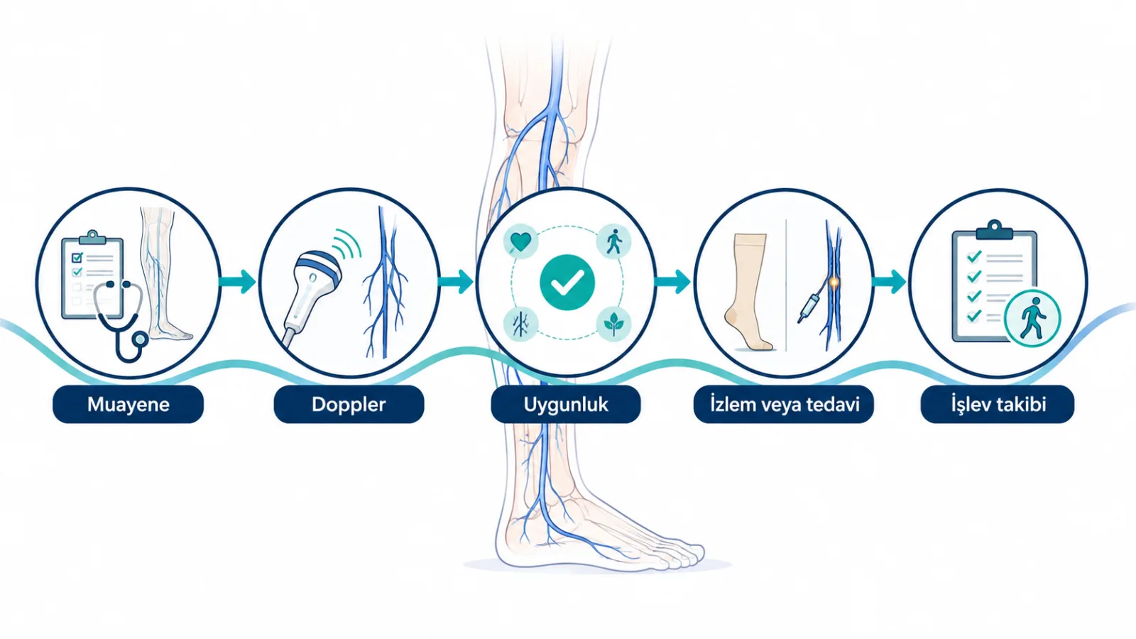 Bacak ağrısında muayene, renkli Doppler, uygunluk değerlendirmesi, izlem veya tedavi seçimi ve işlev takibini gösteren şematik klinik karar akışı.