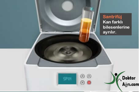 prp hazırlama, santrifüj