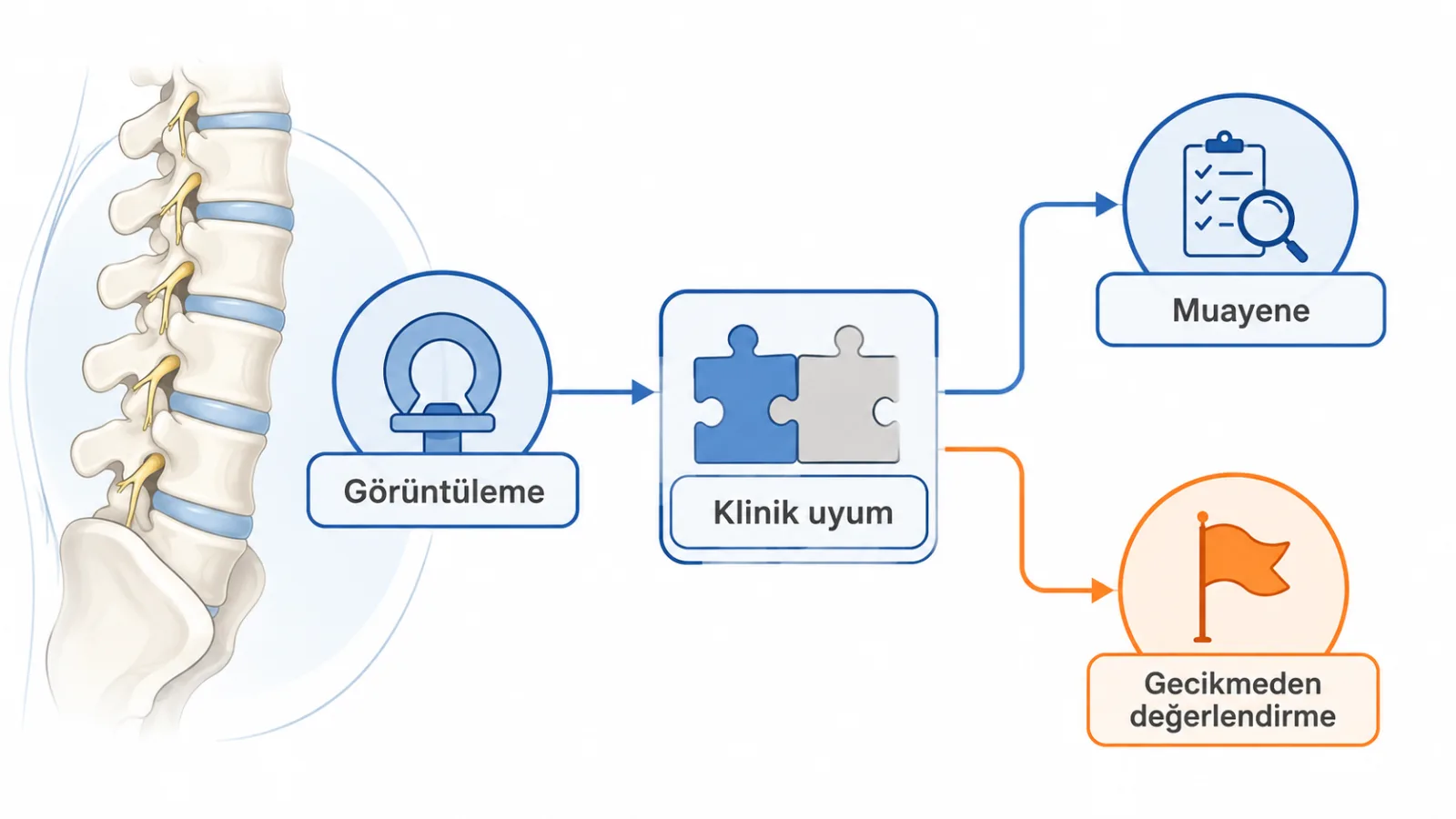 Bel kayması değerlendirmesinde ayakta görüntüleme ile klinik muayenenin birlikte ele alındığını gösteren şematik illüstrasyon; gerçek radyoloji görüntüsü değildir.