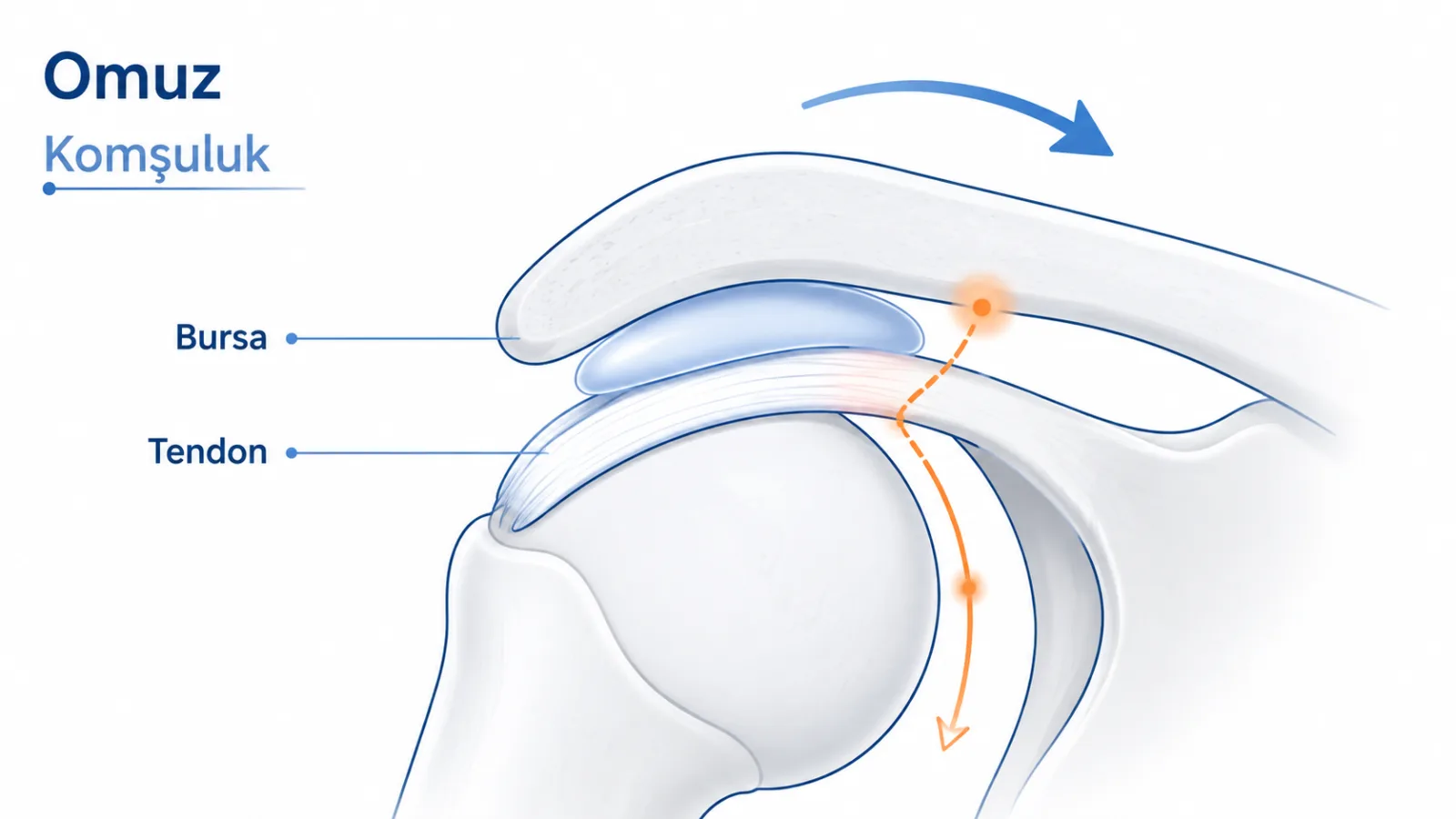 Subakromiyal bursanın omuz hareketi sırasında tendon ve akromion arasındaki komşuluğunu, olası ağrı yolunu gösteren sade mekanizma şeması; gerçek MR değildir.